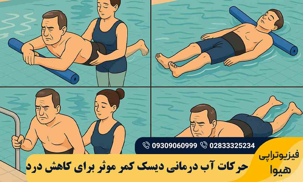 آب درمانی دیسک کمر