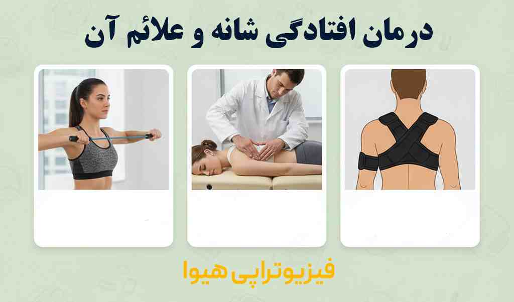 درمان افتادگی شانه