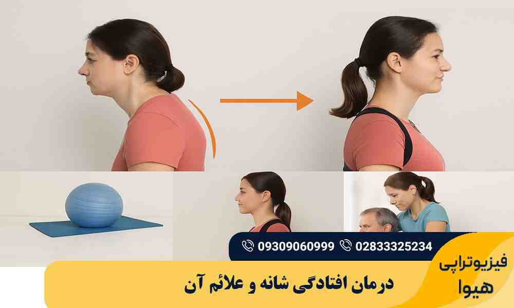 درمان افتادگی شانه