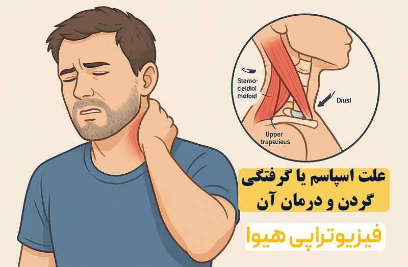 علت اسپاسم یا گرفتگی گردن