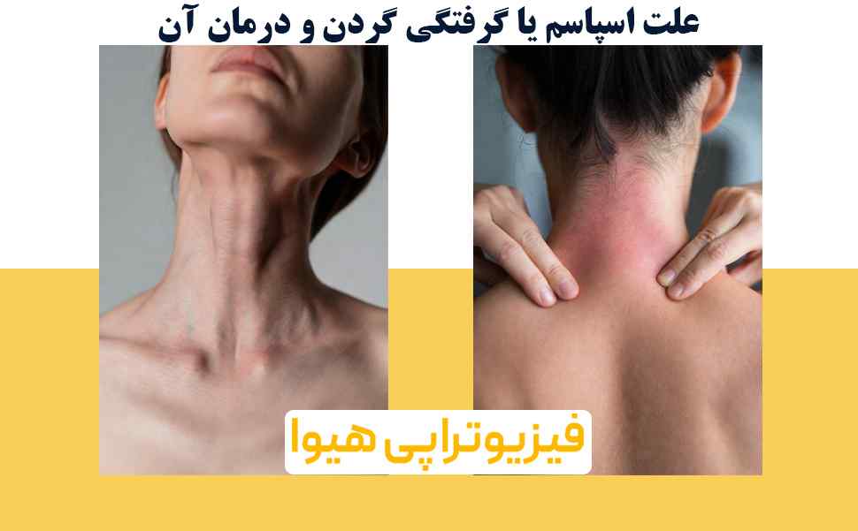 علت اسپاسم یا گرفتگی گردن