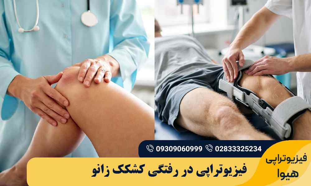 فیزیوتراپی در رفتگی کشکک زانو