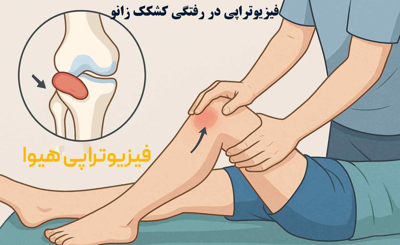 فیزیوتراپی در رفتگی کشکک زانو