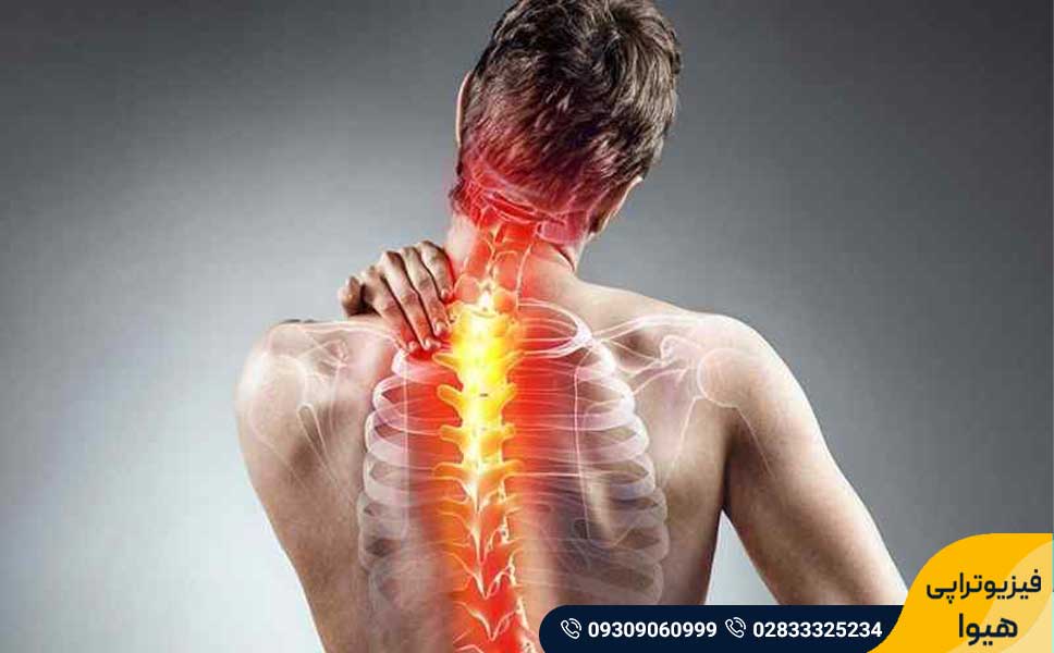 اختلال سیرنگومیلی