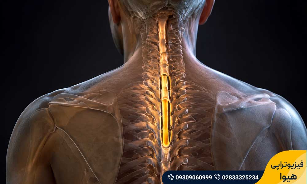 اختلال سیرنگومیلی