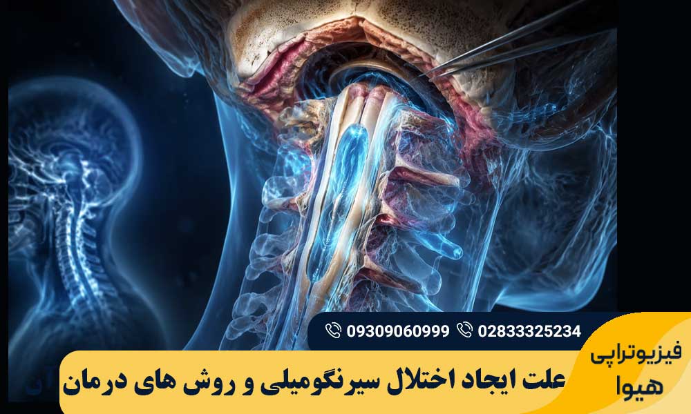 اختلال سیرنگومیلی