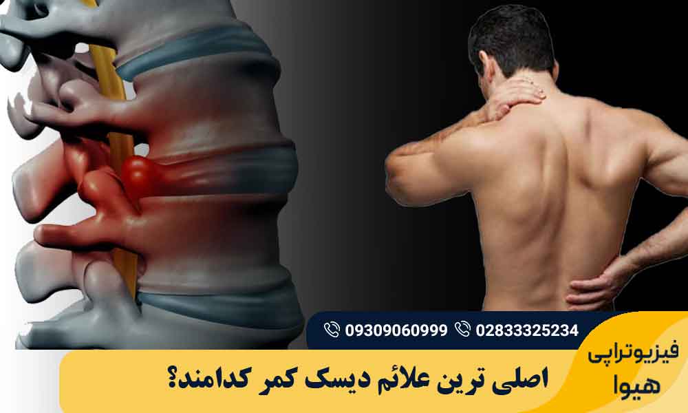 علائم دیسک کمر