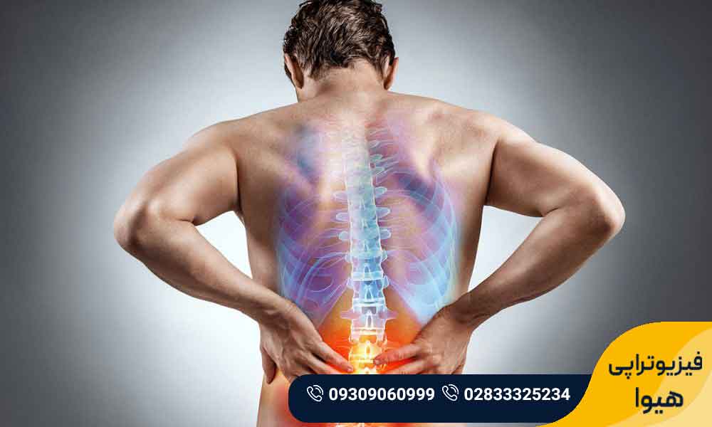 علائم دیسک کمر