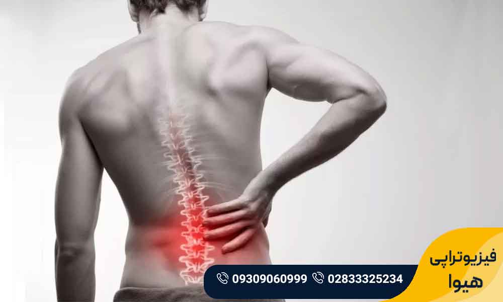 علائم دیسک کمر