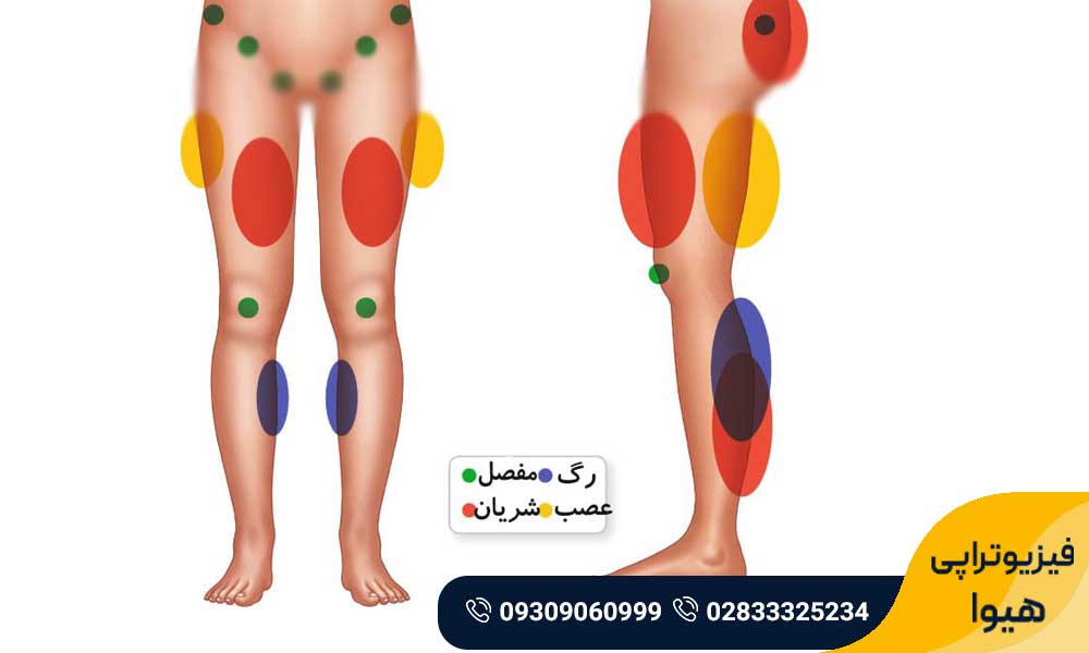 پا درد در شب