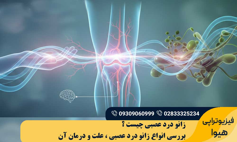 زانو درد عصبی