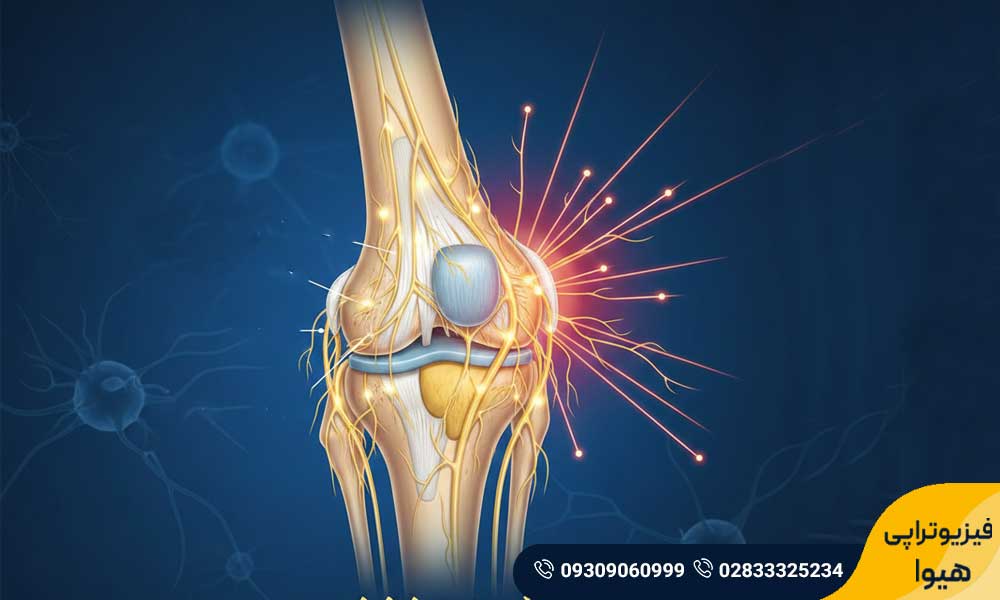 زانو درد عصبی