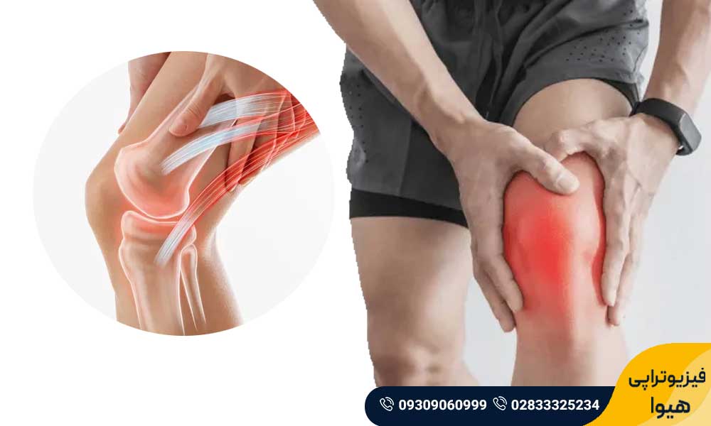 زانو درد عصبی