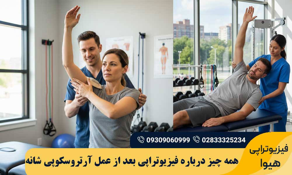 فیزیوتراپی بعد از عمل آرتروسکوپی شانه