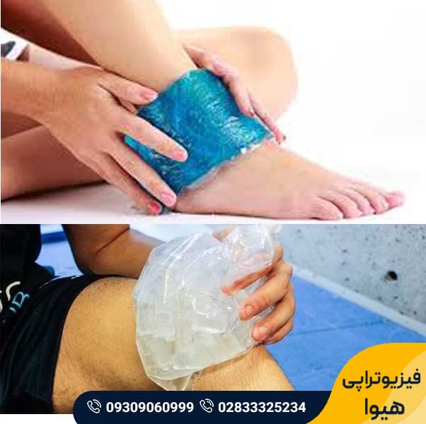 سرما درمانی 