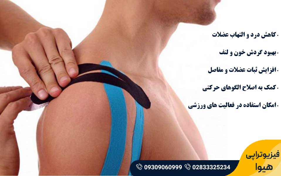 چسب رنگی فیزیوتراپی