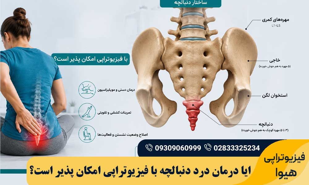 درمان درد دنبالچه با فیزیوتراپی