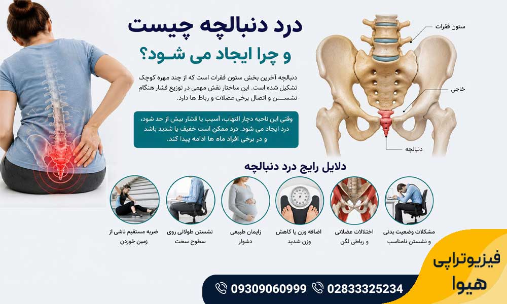 درمان درد دنبالچه با فیزیوتراپی