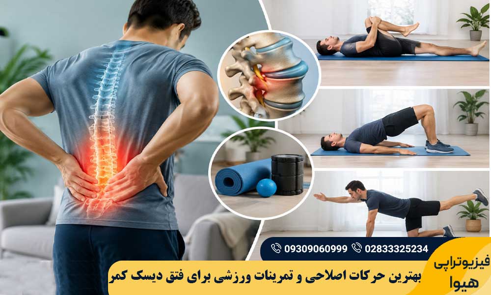 تمرینات ورزشی برای فتق دیسک کمر