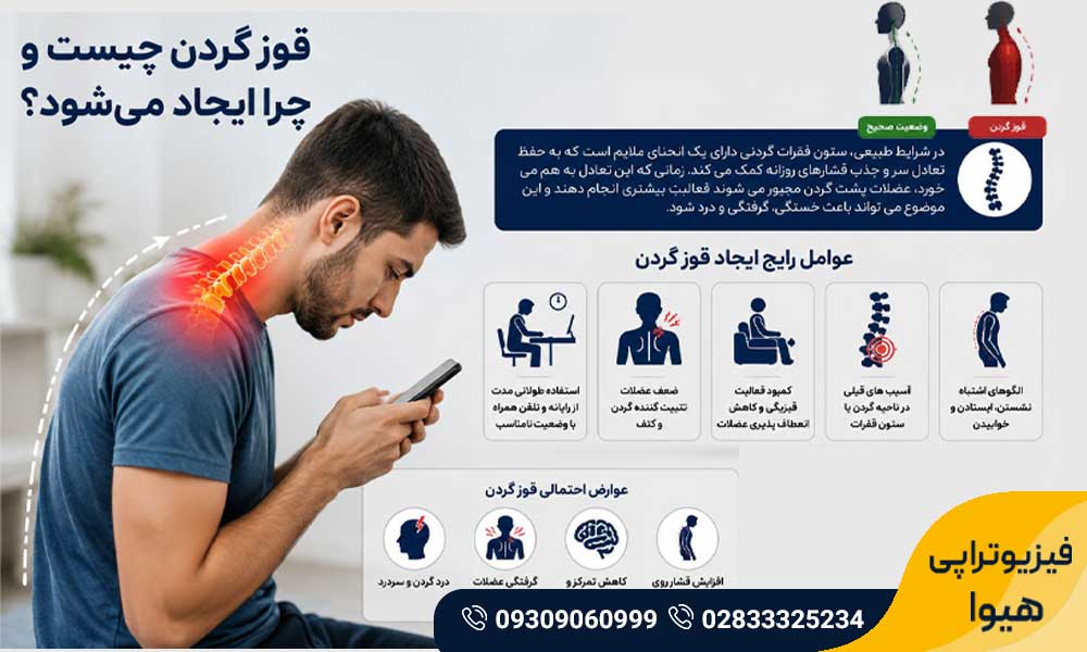 فیزیوتراپی قوز گردن