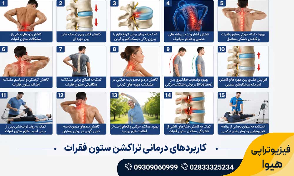 تراکشن ستون فقرات