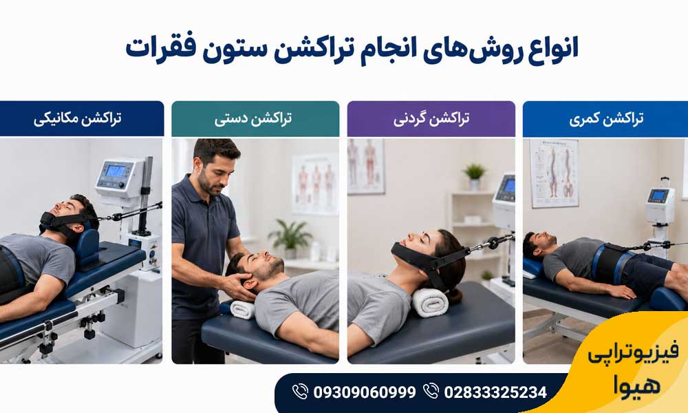 تراکشن ستون فقرات