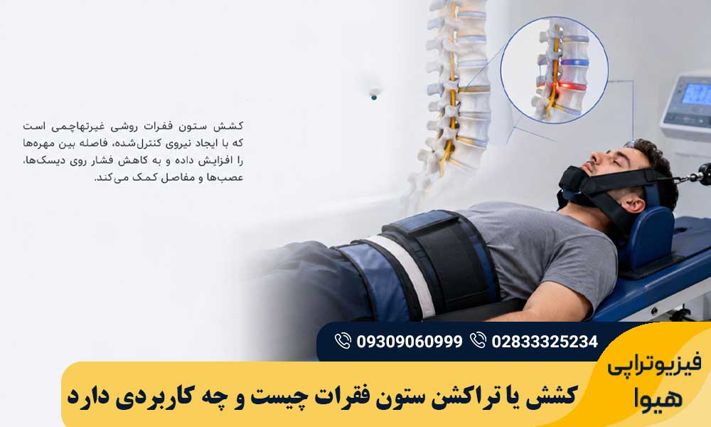 تراکشن ستون فقرات