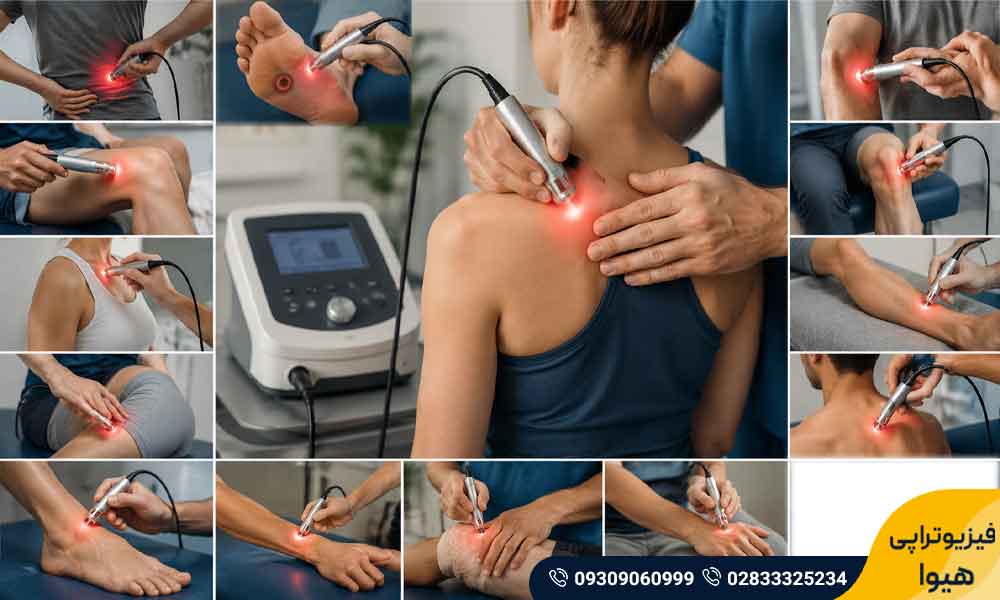 کاربرد لیزر تراپی در فیزیوتراپی