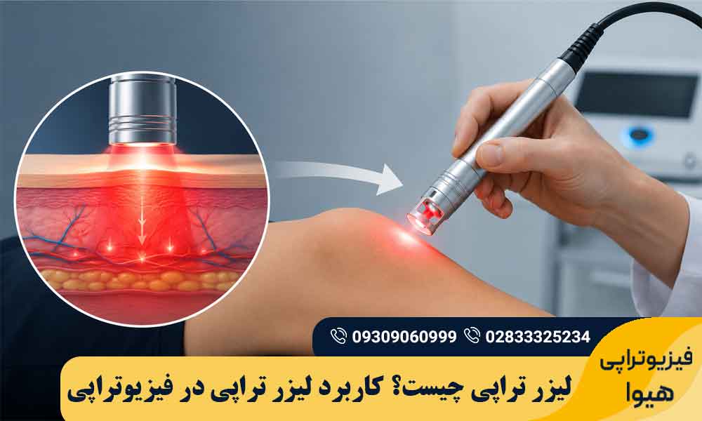 لیزر تراپی چیست