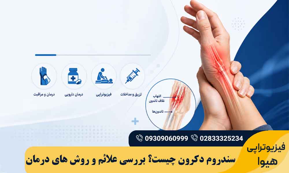 سندروم دکرون